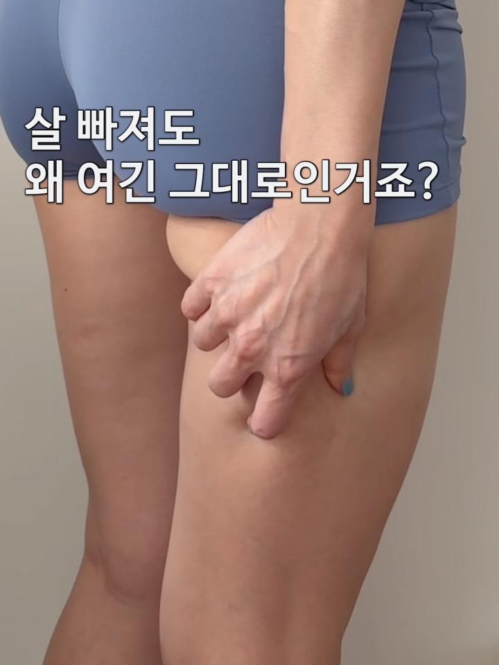 케이스키니X지혜핏